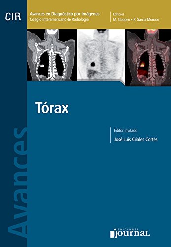 9789871259298: AVANCES EN DIAGNOSTICO POR IMAGENES 2: TORAX (CIR, COLEGIO INTERAMERICANO DE RADIOLOGIA)