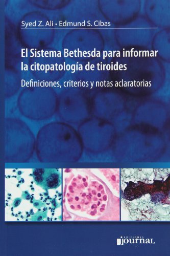 9789871259557: El Sistema Bethesda para Informar la Citopatologia de Tiroides. Definicioines, criterios y notas aclaratorias (Spanish Edition)