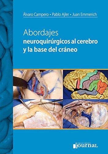 9789871259786: Abordajes neuroquirurgicos al cerebro y la base del craneo (Spanish Edition)