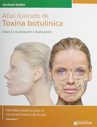 Imagen de archivo de Atlas ilustrado de toxina botulnica (Spanish Edition) a la venta por GF Books, Inc.