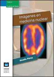 9789871435265: IMAGENES EN MEDICINA NUCLEAR (Spanish Edition)