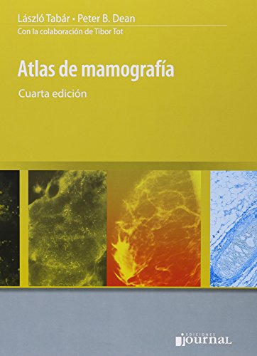 Beispielbild fr Atlas de Mamografa (Spanish Edition) zum Verkauf von Iridium_Books