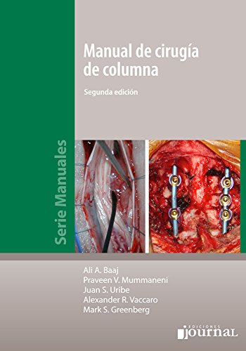 Beispielbild fr Manual De Cirugia De Columna zum Verkauf von Libros del Mundo