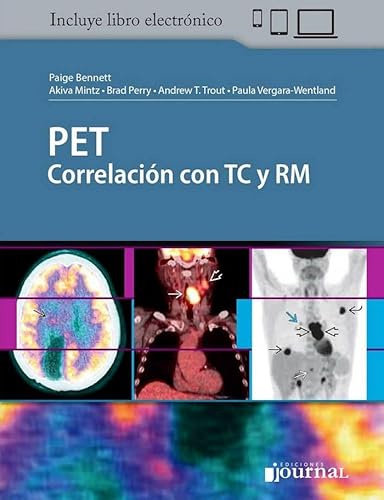 Stock image for Pet Correlaci n Con Tc Y Rm for sale by Libros del Mundo