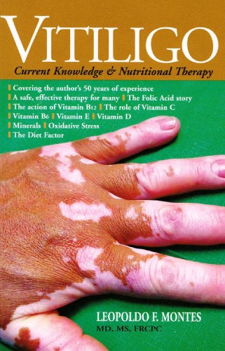 Vitiligo: Current Knowledge & Nutritional Therapy (9789879624029) by MD; MS; FRCPC Leopoldo F. Montes