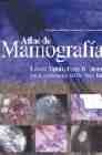 Beispielbild fr Atlas de Mamografia (Spanish Edition) zum Verkauf von Iridium_Books