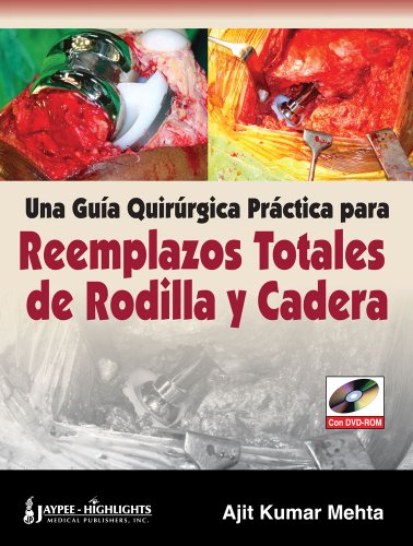 Una Guia Quirurgica Practica para Reemplazos Totales de Rodilla y Cadera (Spanish Edition) (9789962678182) by Kumar