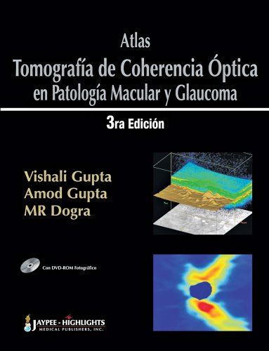 Beispielbild fr Atlas Tomografa de Coherencia Optica en Patologa Macular y Glaucoma 3/e con DVD-ROM Incluido (Spanish Edition) zum Verkauf von HPB-Red