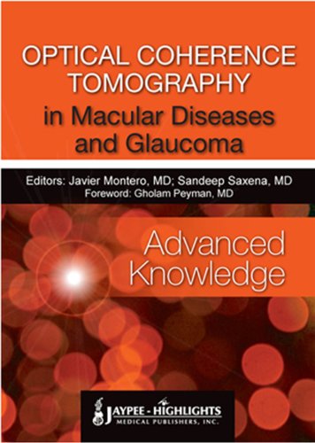 Beispielbild fr Oct in Macular Diseases and Glaucoma zum Verkauf von WorldofBooks