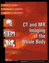 9789997635396: CT and MR Imaging of the Whole Body