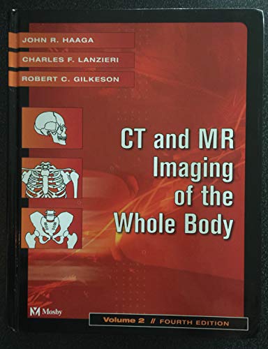 Stock image for Ct and Mr Imaging of the Whole Body VOLUME 2 for sale by D2D Books