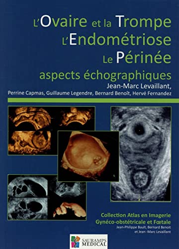 Beispielbild fr L'Ovaire et la Trompe, l'Endomtriose, le Prine : Aspects chographiques zum Verkauf von medimops