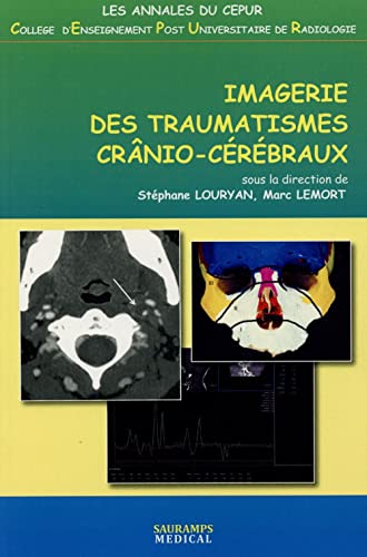 Stock image for IMAGERIE DES TRAUMATISMES CRANIO-CEREBRAUX (0000) LOURYAN LEMORT; Louryan, Stphane et Lemort, Marc for sale by BIBLIO-NET