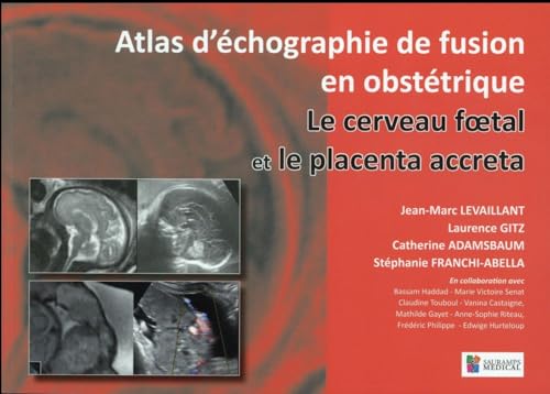 Beispielbild fr Le Cerveau Foetal Et Le Placenta Accreta: Atlas D'chographie De Fusion En Gyncologie (French Edition) zum Verkauf von Gallix