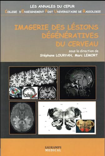 Stock image for IMAGERIE DES LESIONS DEGENERATIVES DU CERVEAU for sale by Gallix