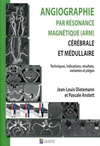 Imagen de archivo de ANGIOGRAPHIE PAR RESONANCE MAGNETIQUE (ARM) CEREBRALE ET MEDULLAIRE a la venta por Gallix