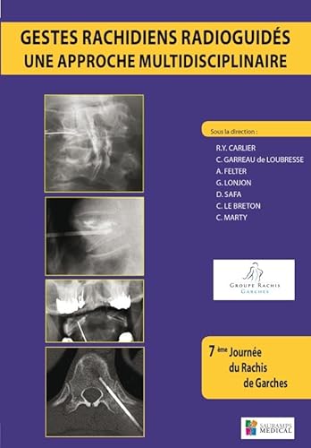 Beispielbild fr GESTES RACHIDIENS RADIOGUIDES-UNE APPROCHE [Broch] CARLIER RY zum Verkauf von BIBLIO-NET