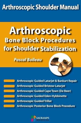 Stock image for SHOULDER CONCEPTS BON BLOCK PROCEDURES FOR SHOULDER STABILIZATION: COLL NICE SHOULDER for sale by Ammareal