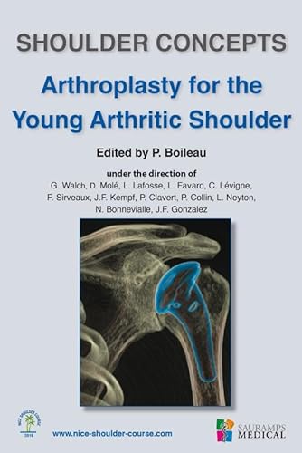 Stock image for Shoulder Concepts: Arthroplasty for the Young Arthritic Shoulder (French Edition) for sale by Gallix