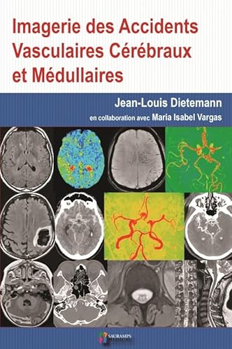 Imagen de archivo de IMAGERIE DES ACCIDENTS VASCULAIRES CEREBRAUX ET MEDULLAIRES a la venta por Gallix