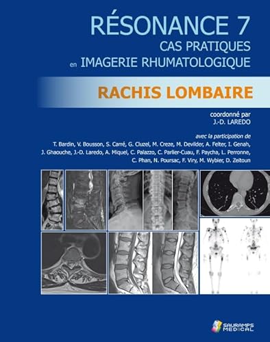 Stock image for RESONANCE 7 - RACHIS LOMBAIRE: CAS PRATIQUES IMAGERIE RHUMATOLOGIQUE for sale by Gallix