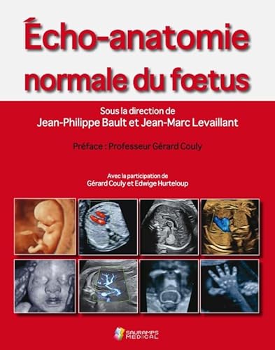 Beispielbild fr Echo-anatomie Normale Du Foetus zum Verkauf von RECYCLIVRE