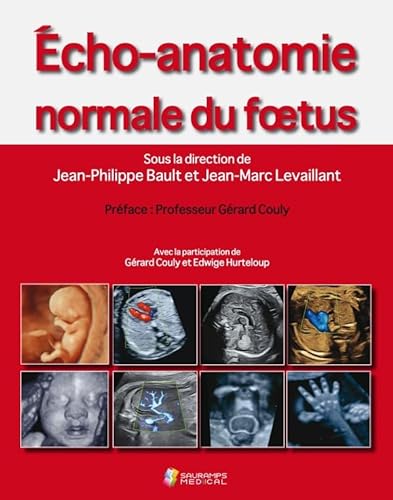 Stock image for Echo-anatomie normale du foetus for sale by medimops