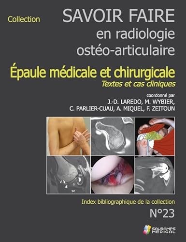Beispielbild fr Savoir Faire En Radiologie Osto-articulaire. Vol. 23. Epaule Mdicale Et Chirurgicale : Textes Et C zum Verkauf von RECYCLIVRE