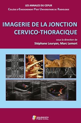 9791030303179: IMAGERIE DE LA JONCTION CERVICO-THORACIQUE: ANNALES DU CEPUR- COLL ENSEIGNEMENT POST-UNIVERSITAIRE DE RADIOLOGIE