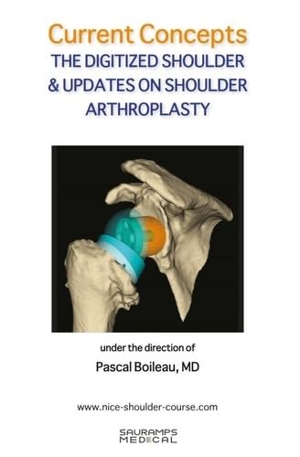 Stock image for CURRENT CONCEPTS. THE DIGITIZED SHOULDER & UPDATES ON SHOULDER ARTHROSCOPY: COLL NICE SHOULDER for sale by Gallix