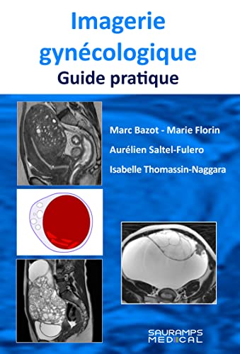 Beispielbild fr Imagerie Gyncologique : Guide Pratique zum Verkauf von RECYCLIVRE