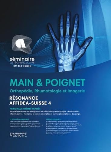 Stock image for Main & poignet. Orthopdie, Rhumatologie. Imagerie: Rsonance Affidea Suisse 4 for sale by Ammareal