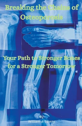 Stock image for Breaking the Chains of Osteoporosis for sale by California Books