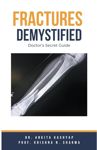 Beispielbild fr Fractures Demystified: Doctor's Secret Guide zum Verkauf von Buchpark