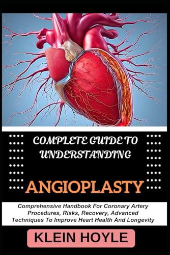 9798328623070: COMPLETE GUIDE TO UNDERSTANDING ANGIOPLASTY: Comprehensive Handbook For Coronary Artery Procedures, Risks, Recovery, Advanced Techniques To Improve Heart Health And Longevity