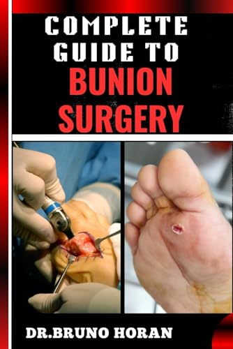 Beispielbild fr COMPLETE GUIDE TO BUNION SURGERY: Essential Handbook For Expert Techniques, Recovery Tips, And Pain Management For Optimal Foot Health zum Verkauf von Ria Christie Collections