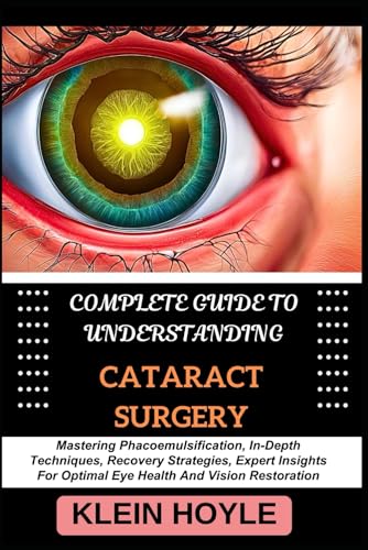 9798328821346: COMPLETE GUIDE TO UNDERSTANDING CATARACT SURGERY: Mastering Phacoemulsification, In-Depth Techniques, Recovery Strategies, Expert Insights For Optimal Eye Health And Vision Restoration