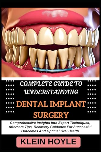 9798328911320: COMPLETE GUIDE TO UNDERSTANDING DENTAL IMPLANT SURGERY: Comprehensive Insights Into Expert Techniques, Aftercare Tips, Recovery Guidance For Successful Outcomes And Optimal Oral Health