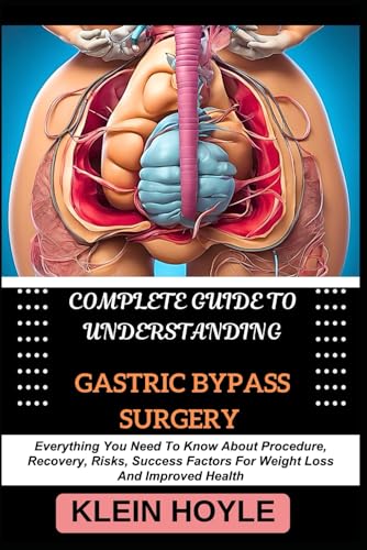 9798329074468: COMPLETE GUIDE TO UNDERSTANDING GASTRIC BYPASS SURGERY: Everything You Need To Know About Procedure, Recovery, Risks, Success Factors For Weight Loss And Improved Health