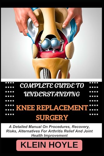 Immagine dell'editore per COMPLETE GUIDE TO UNDERSTANDING KNEE REPLACEMENT SURGERY: A Detailed Manual On Procedures, Recovery, Risks, Alternatives For Arthritis Relief And Joint Health Improvement venduto da Ria Christie Collections