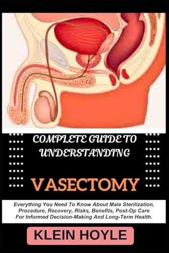 9798332052729: COMPLETE GUIDE TO UNDERSTANDING VASECTOMY: Everything You Need To Know About Male Sterilization, Procedure, Recovery, Risks, Benefits, Post-Op Care For Informed Decision-Making And Long-Term Health.