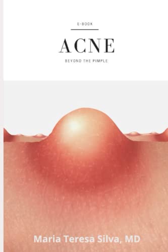 Stock image for Acne: beyond a pimple for sale by Ria Christie Collections
