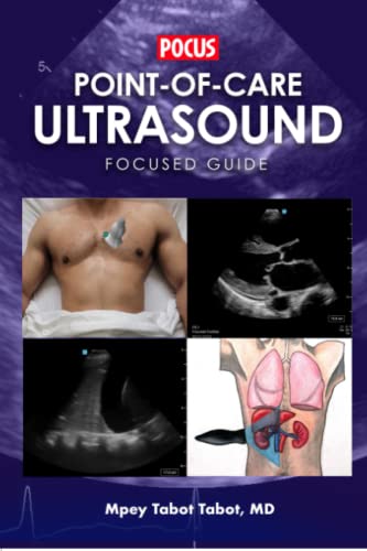 9798392083244: POINT-OF-CARE ULTRASOUND FOCUSED GUIDE