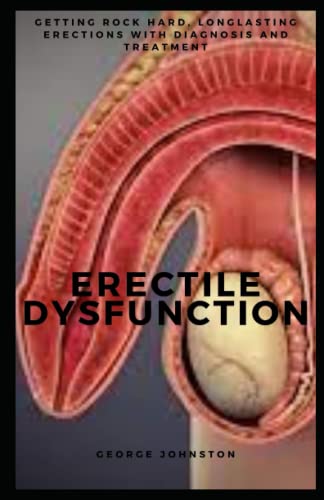 9798424108815: ERECTILE DYSFUNCTION: Getting rock hard, longlasting erections with diagnosis and treatment