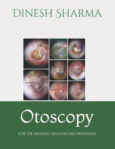Stock image for Otoscopy: For the Hearing Healthcare Provider for sale by Ria Christie Collections