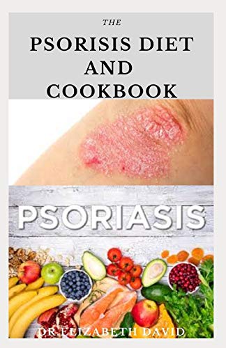 Psoriasis diet deals