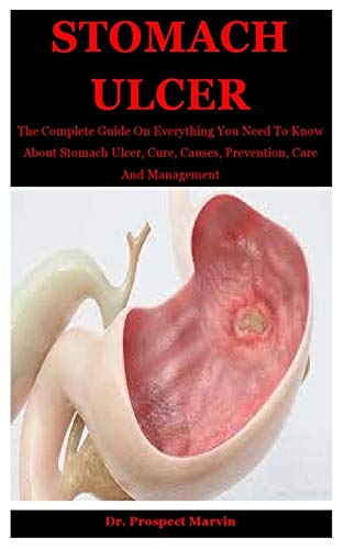 Stock image for Stomach Ulcer: The Complete Guide On Everything You Need To Know About Stomach Ulcer, Cure, Causes, Prevention, Care And Management for sale by GreatBookPrices