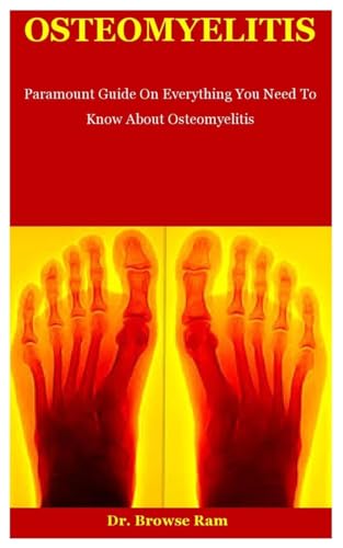 9798673086506: Osteomyelities: Paramount Guide On Everything You Need To Know About Osteomyelitis