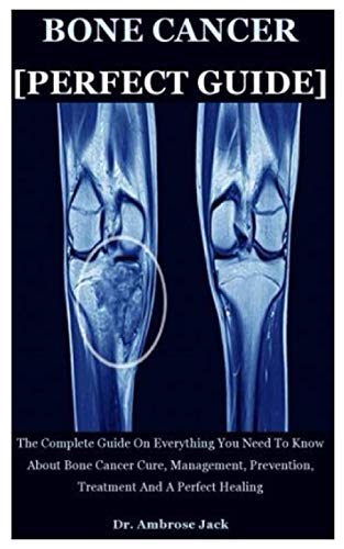 9798685982230: Bone Cancer [Perfect Guide]: The Complete Guide On Everything You Need To Know About Bone Cancer Cure, Management, Prevention, Treatment And A Perfect Healing