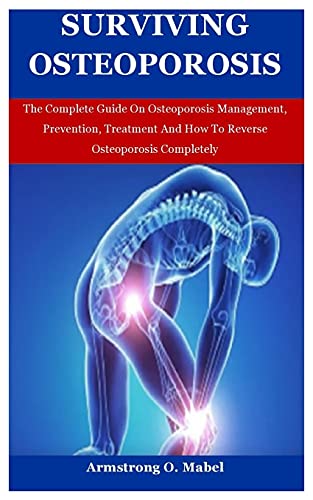 9798737434977: Surviving Oteoporosis: The Complete Guide On Osteoporosis Management, Prevention, Treatment And How To Reverse Osteoporosis Completely